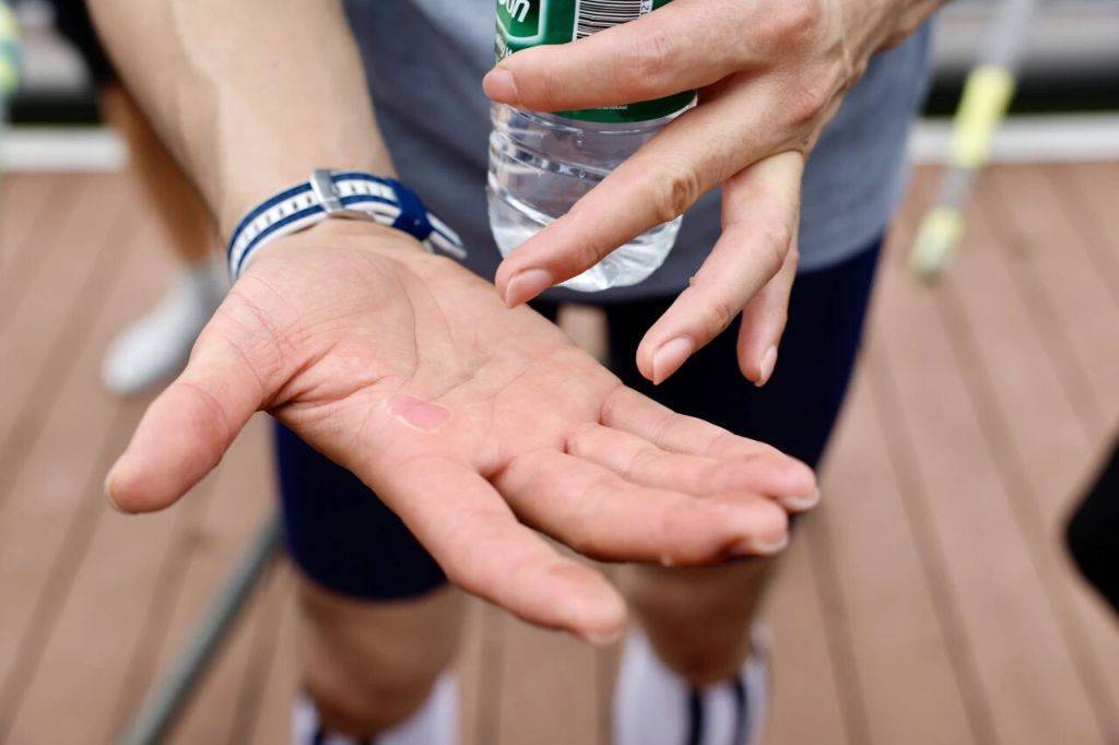 https, cn, 的皮又磨掉